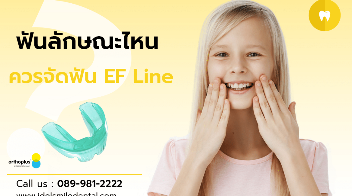 ฟันลักษณะไหน ควรจัดฟัน EF Line