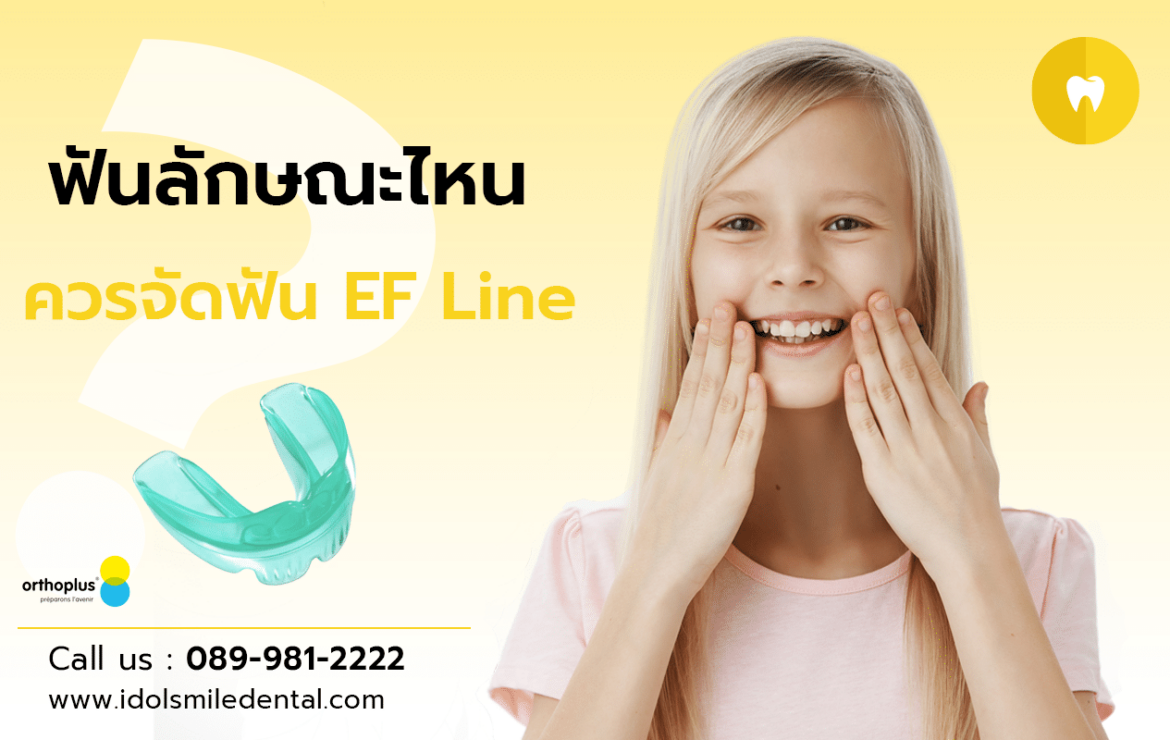 ฟันลักษณะไหน ควรจัดฟัน EF Line