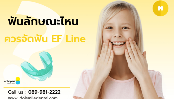 ฟันลักษณะไหน ควรจัดฟัน EF Line