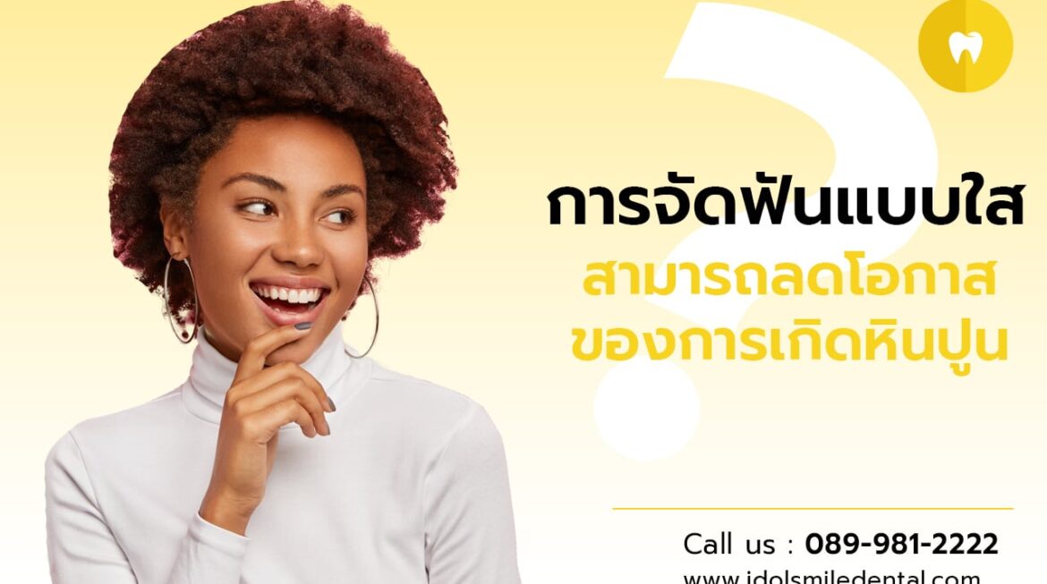 การจัดฟันแบบใส สามารถลดโอกาสของการเกิดหินปูนได้จริงหรือไม่