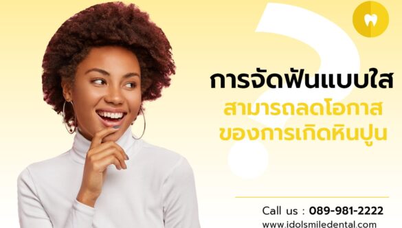 การจัดฟันแบบใส สามารถลดโอกาสของการเกิดหินปูนได้จริงหรือไม่