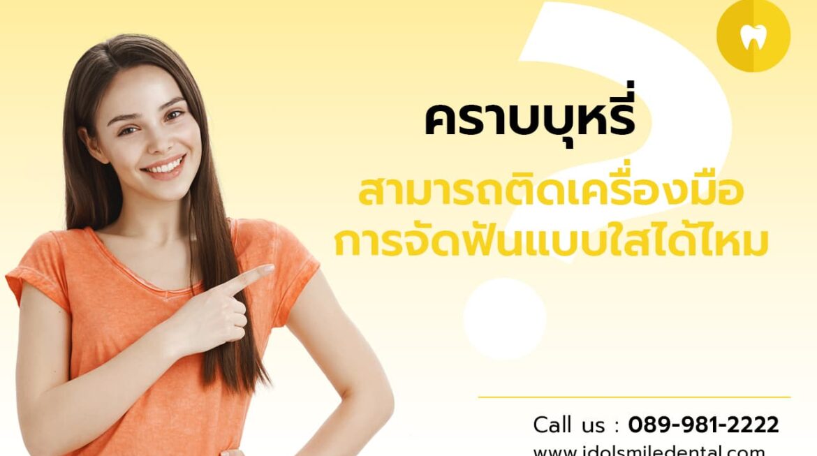 คราบบุหรี่ สามารถติดเครื่องมือการจัดฟันแบบใส