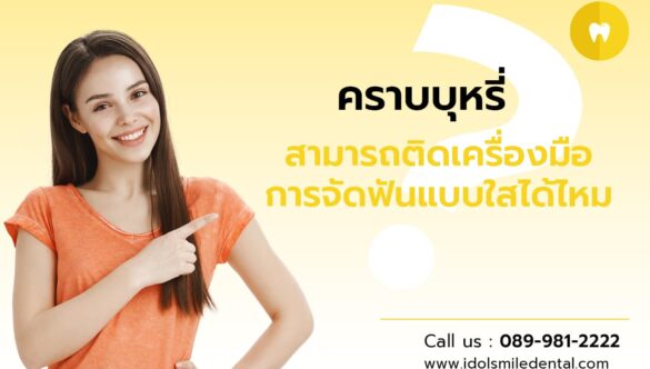 คราบบุหรี่ สามารถติดเครื่องมือการจัดฟันแบบใส