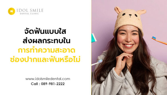 การจัดฟันแบบใส ส่งผลต่อการทำความสะอาดช่องปากและฟันหรือไม่