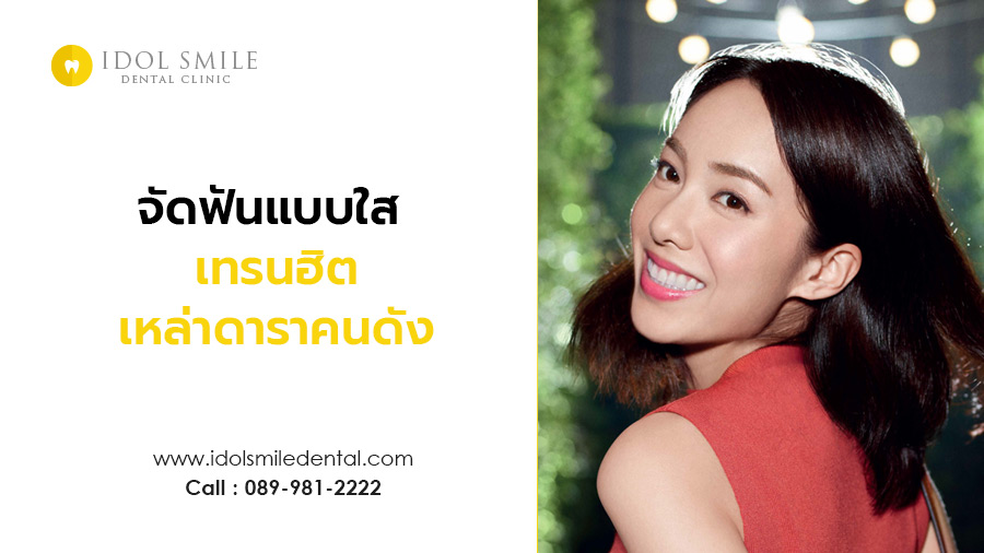 จัดฟันแบบใส เทรนฮิต เหล่าดาราคนดัง