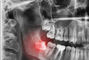 istockphoto-1182509269-612x612