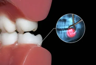 istockphoto-547514206-612x612