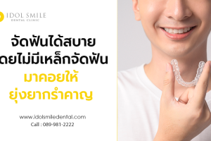 จัดฟันได้สบาย โดยไม่มีเหล็กจัดฟันมาคอยให้ยุ่งยากรำคาญ