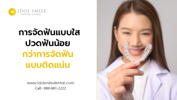 การจัดฟันแบบใส ปวดฟันน้อยกว่าการจัดฟันแบบติดแน่น