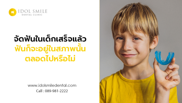 จัดฟันในเด็กเสร็จแล้วฟันก็จะอยู่ในสภาพนั้นตลอดไปหรือไม่