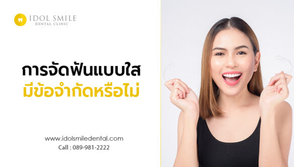 การจัดฟันแบบใส มีข้อจำกัดหรือไม่