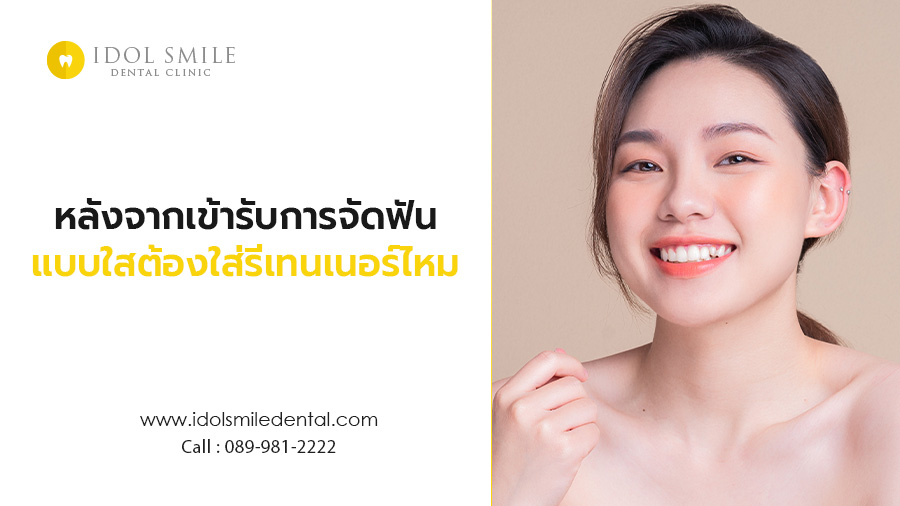 หลังจากเข้ารับการจัดฟันแบบใส ต้องใส่รีเทนเนอร์ไหม