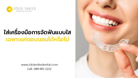 ใส่เครื่องมือการจัดฟันแบบใส เฉพาะแค่ตอนนอนได้หรือไม่