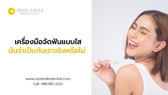 เครื่องมือจัดฟันแบบใส มันจำเป็นกับเราจริงหรือไม่