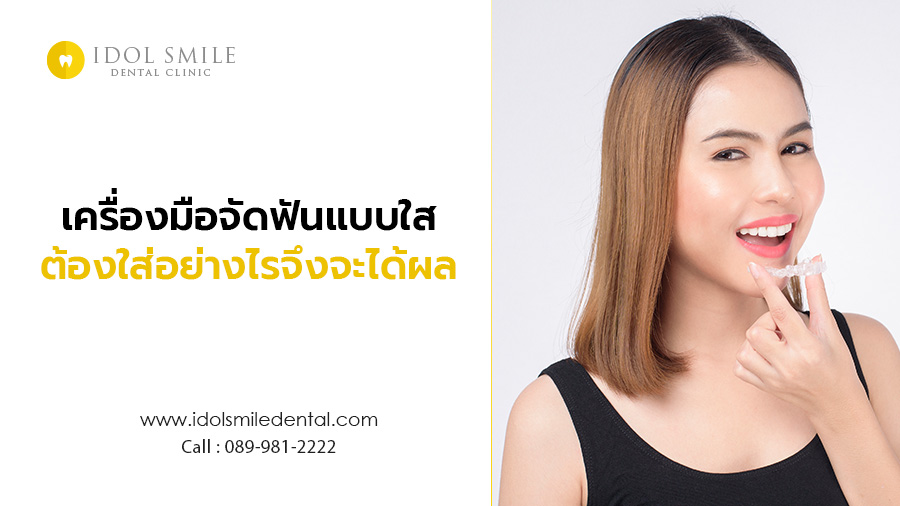 เครื่องมือจัดฟันแบบใส ต้องใส่อย่างไร จึงจะได้ผล
