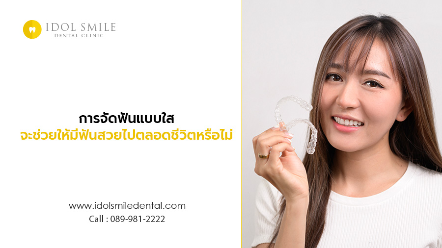 การจัดฟันแบบใส จะช่วยให้มีฟันสวยไปตลอดชีวิตหรือไม่