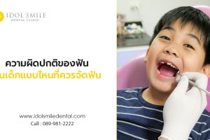 ความผิดปกติของฟันในเด็กแบบไหนที่ควรจัดฟัน
