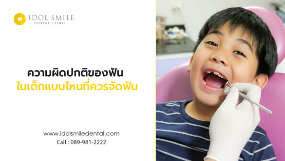 ความผิดปกติของฟันในเด็กแบบไหนที่ควรจัดฟัน