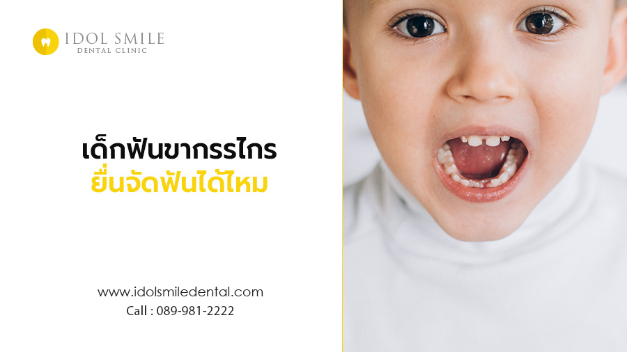 เด็กฟันขากรรไกรยื่นจัดฟันได้ไหม