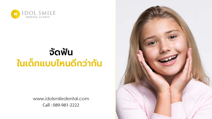 จัดฟันในเด็กแบบไหนดีกว่ากัน