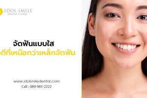 จัดฟันแบบใส ข้อดี ที่เหนือกว่าเหล็กจัดฟัน