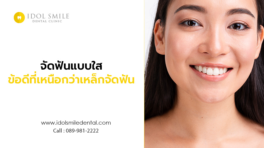 จัดฟันแบบใส ข้อดี ที่เหนือกว่าเหล็กจัดฟัน